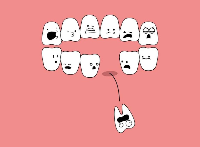 Nằm mơ thấy gãy răng là điềm lành hay xấu?